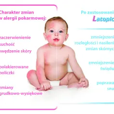 Objawy AZS u niemowlaka: Jak rozpoznać i złagodzić uciążliwe dolegliwości